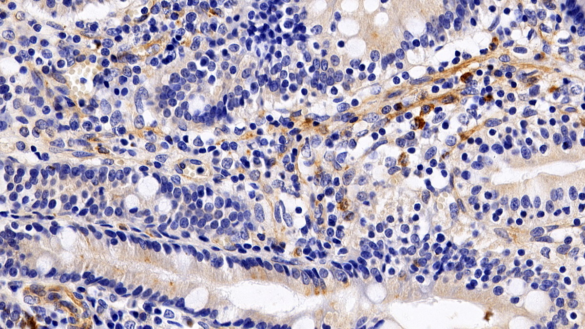Sialic Acid Binding Ig Like Lectin 7 (SIGLEC7) Human Monoclonal Antibody