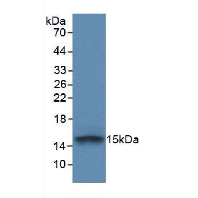 Fibroblast Growth Factor Receptor 1 (FGFR1) Human Monoclonal Antibody