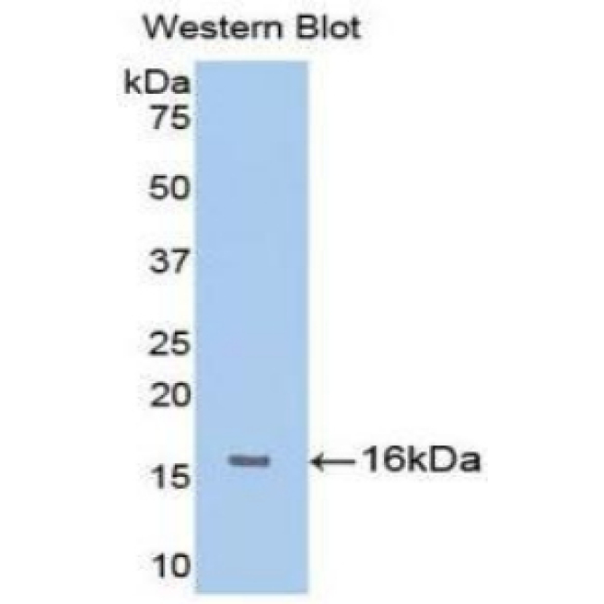 Fibroblast Growth Factor Receptor 1 (FGFR1) Human Monoclonal Antibody