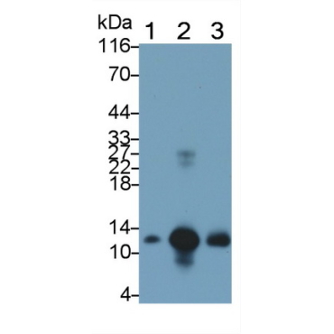 S100 Calcium Binding Protein A8 (S100A8) Human Monoclonal Antibody
