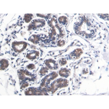 S100 Calcium Binding Protein A8 (S100A8) Human Monoclonal Antibody