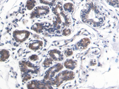 S100 Calcium Binding Protein A8 (S100A8) Human Monoclonal Antibody