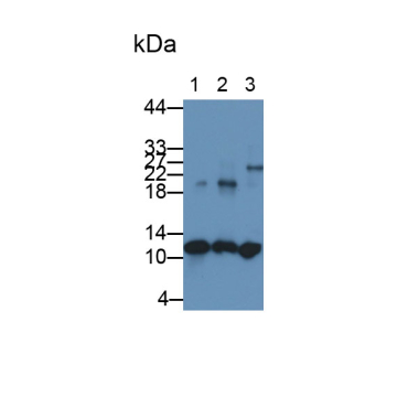 S100 Calcium Binding Protein A8 (S100A8) Human Monoclonal Antibody