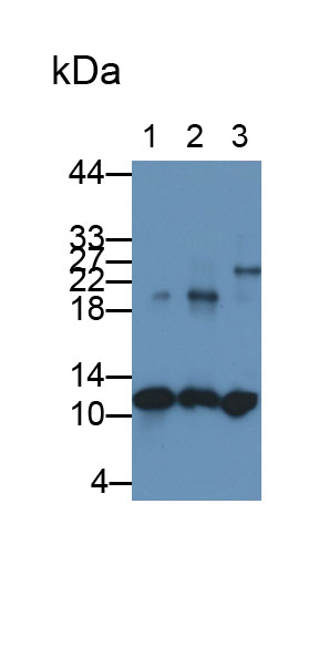 S100 Calcium Binding Protein A8 (S100A8) Human Monoclonal Antibody