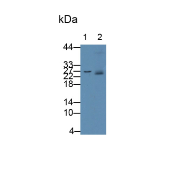 S100 Calcium Binding Protein A8 (S100A8) Human Monoclonal Antibody