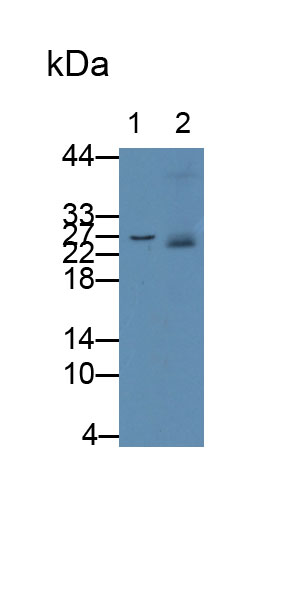 S100 Calcium Binding Protein A8 (S100A8) Human Monoclonal Antibody