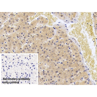 S100 Calcium Binding Protein A9 (S100A9) Human Monoclonal Antibody