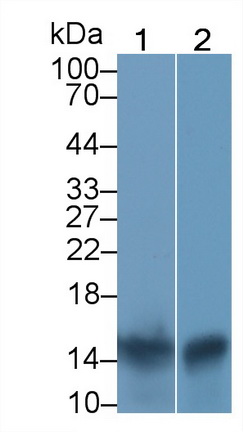 S100 Calcium Binding Protein A9 (S100A9) Human Monoclonal Antibody