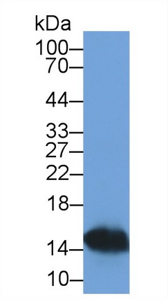S100 Calcium Binding Protein A9 (S100A9) Human Monoclonal Antibody