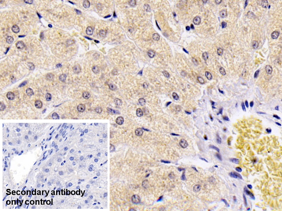 S100 Calcium Binding Protein A9 (S100A9) Human Monoclonal Antibody