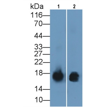 S100 Calcium Binding Protein A9 (S100A9) Human Monoclonal Antibody