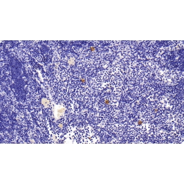 S100 Calcium Binding Protein A9 (S100A9) Human Monoclonal Antibody