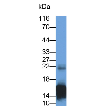 S100 Calcium Binding Protein A9 (S100A9) Human Monoclonal Antibody