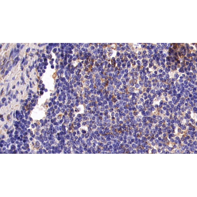 Cluster Of Differentiation 5 (CD5) Human Monoclonal Antibody