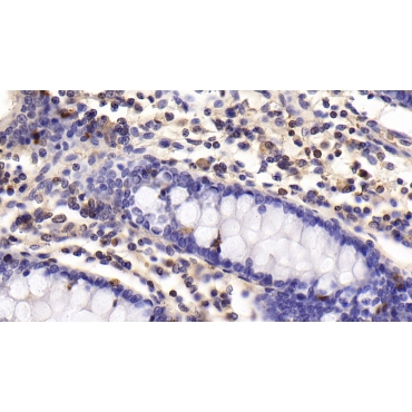Cluster Of Differentiation 5 (CD5) Human Monoclonal Antibody