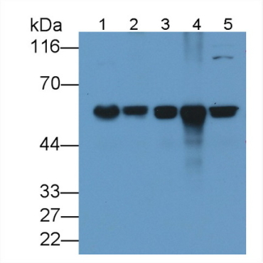 Cluster Of Differentiation 5 (CD5) Human Monoclonal Antibody