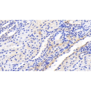 Serine/threonine-protein kinase mTOR (mTOR) Human Monoclonal Antibody