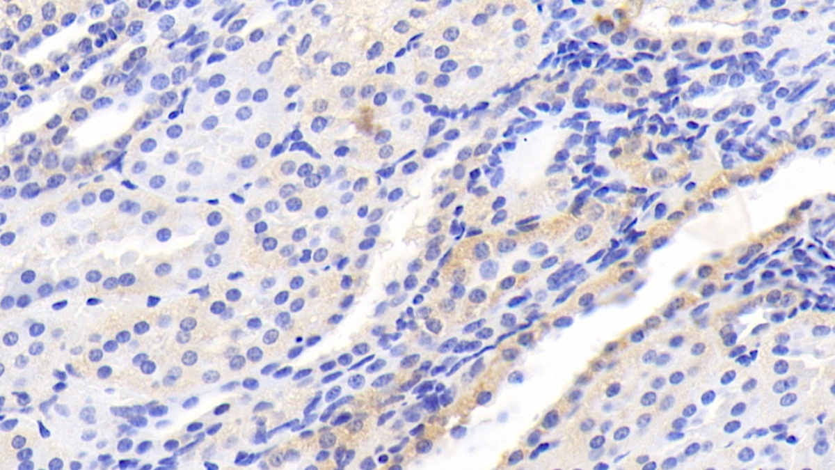Serine/threonine-protein kinase mTOR (mTOR) Human Monoclonal Antibody