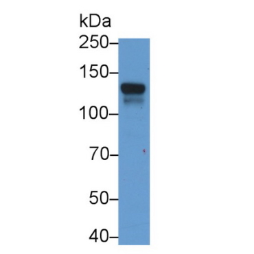 Jagged 1 (JAG1) Human Monoclonal Antibody