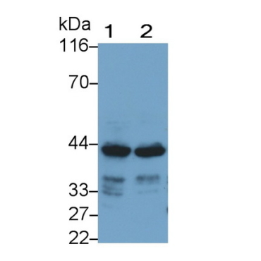 Selenoprotein P1, Plasma (SEPP1) Human Monoclonal Antibody