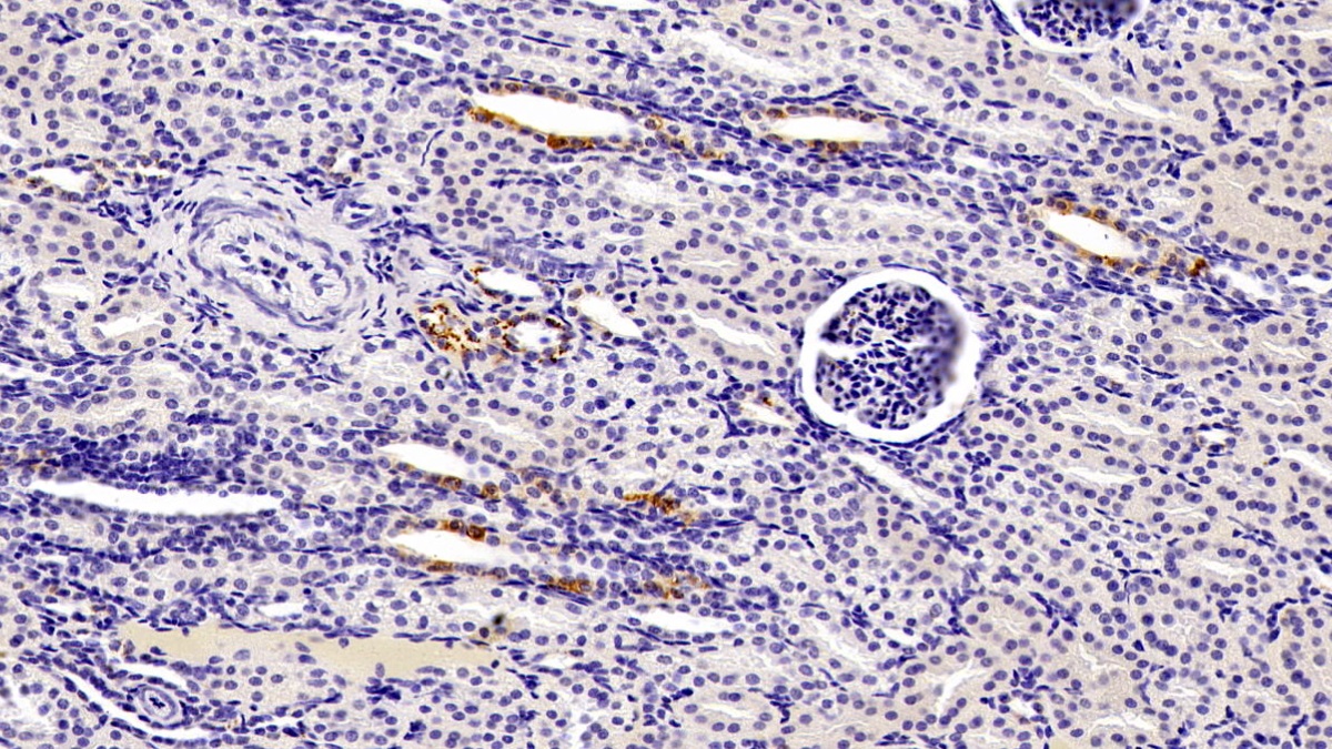 Selenoprotein P1, Plasma (SEPP1) Human Monoclonal Antibody