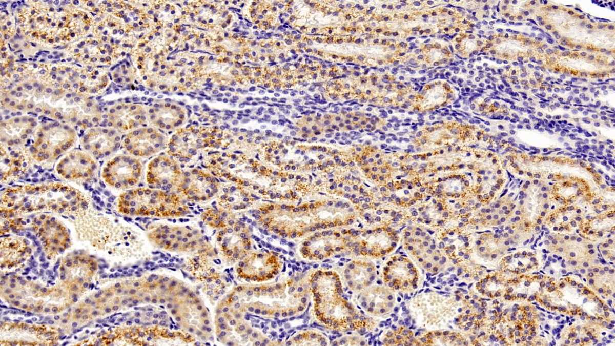 Selenoprotein P1, Plasma (SEPP1) Human Monoclonal Antibody