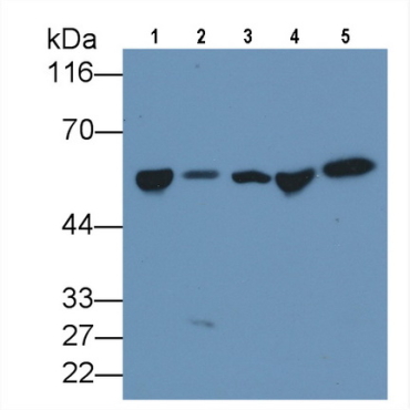 Vitamin D Binding Protein (DBP) Human Monoclonal Antibody