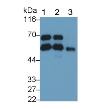 Vitamin D Binding Protein (DBP) Human Monoclonal Antibody