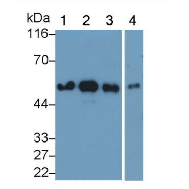 Vitamin D Binding Protein (DBP) Human Monoclonal Antibody