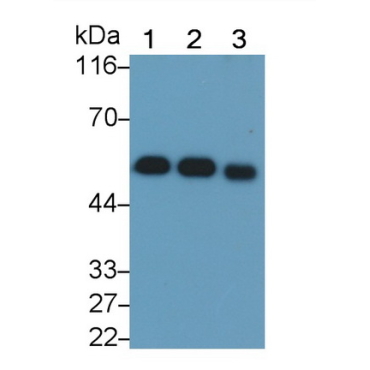 Vitamin D Binding Protein (DBP) Human Monoclonal Antibody