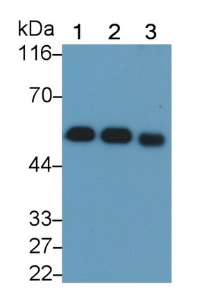 Vitamin D Binding Protein (DBP) Human Monoclonal Antibody
