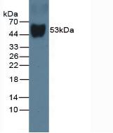 Vitamin D Binding Protein (DBP) Rat Monoclonal Antibody