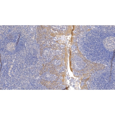 Cytokeratin 17 (CK17) Human Monoclonal Antibody