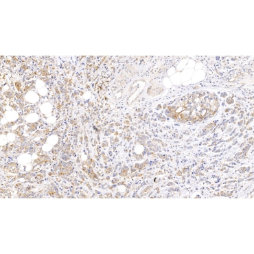 Cytokeratin 17 (CK17) Human Monoclonal Antibody