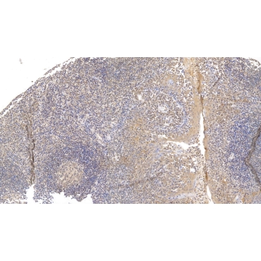 Cytokeratin 17 (CK17) Human Monoclonal Antibody