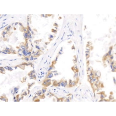 Cytokeratin 17 (CK17) Human Monoclonal Antibody