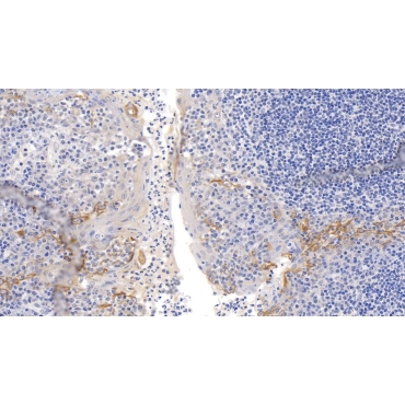 Cytokeratin 17 (CK17) Human Monoclonal Antibody