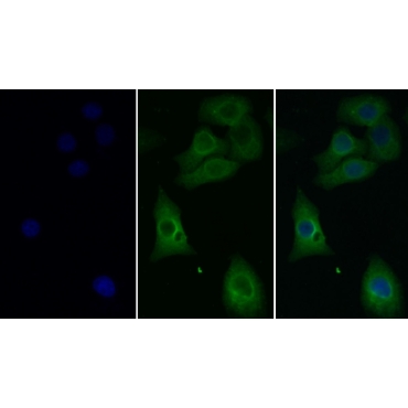 Transglutaminase 2 (TGM2) Mouse Monoclonal Antibody