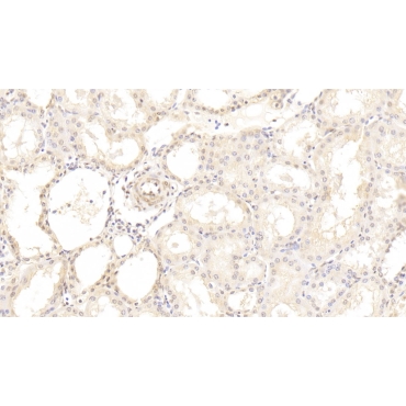 Hedgehog Homolog, Sonic (SHH) Human Monoclonal Antibody