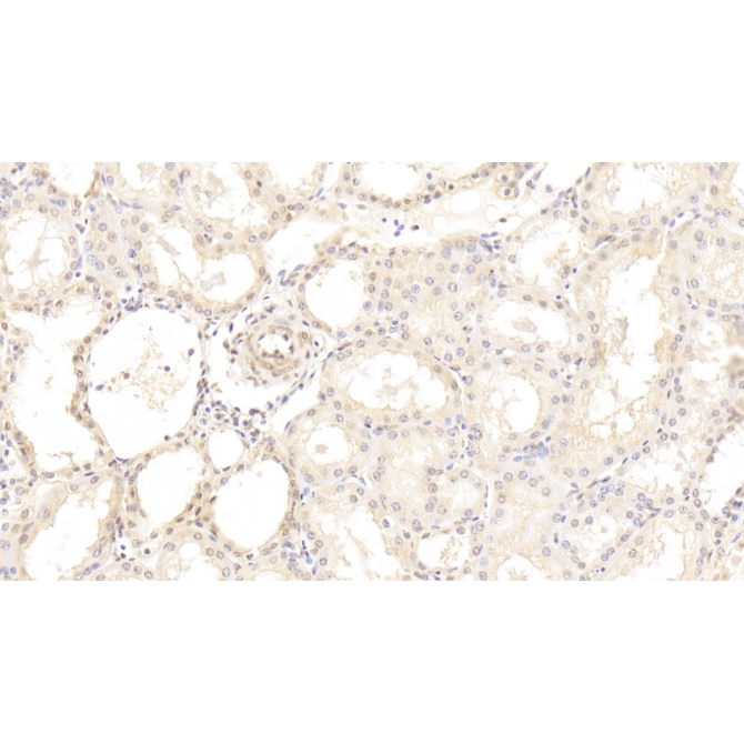 Hedgehog Homolog, Sonic (SHH) Human Monoclonal Antibody