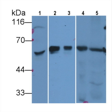 Hedgehog Homolog, Sonic (SHH) Human Monoclonal Antibody