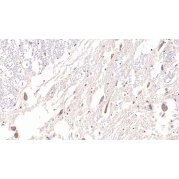 Hedgehog Homolog, Sonic (SHH) Human Monoclonal Antibody
