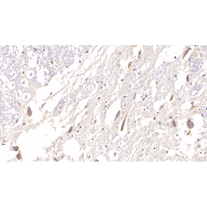 Hedgehog Homolog, Sonic (SHH) Human Monoclonal Antibody