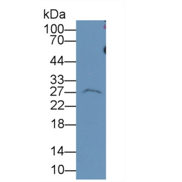 Complement Factor D (CFD) Human Monoclonal Antibody