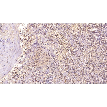 Complement Factor D (CFD) Human Monoclonal Antibody