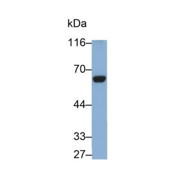 Coagulation Factor XI (F11) Human Monoclonal Antibody