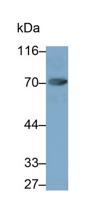 Coagulation Factor XI (F11) Human Monoclonal Antibody