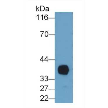 Interleukin 2 Receptor Alpha (IL2Ra) Human Monoclonal Antibody