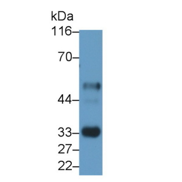 Interleukin 2 Receptor Alpha (IL2Ra) Human Monoclonal Antibody