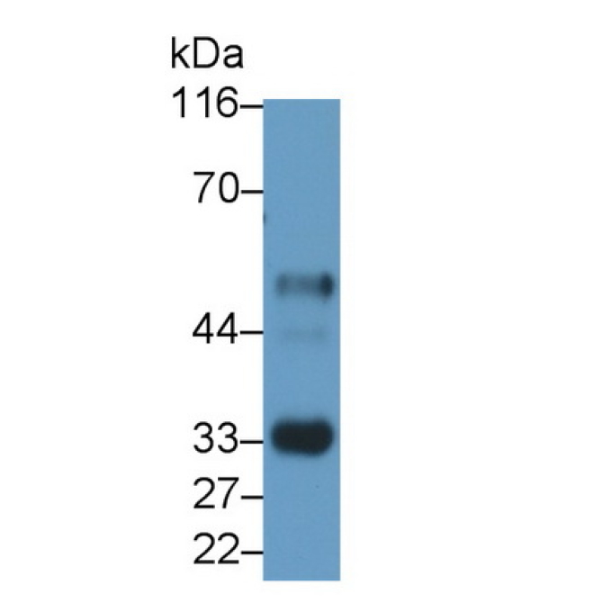 Interleukin 2 Receptor Alpha (IL2Ra) Human Monoclonal Antibody